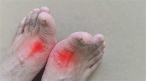 11 causas del dolor en los dedos de los pies - Mejor con Salud