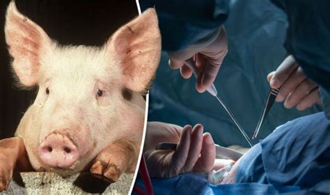 Pig organs to be used transplants into people in just TWO years ...