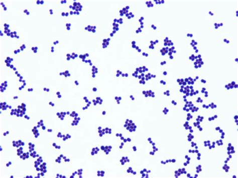 S saprophyticus Gram stain