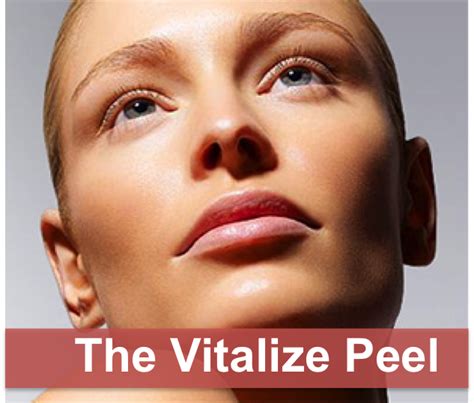 University Dermatology | The Vitalize Peel