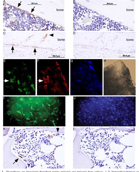 Figure 1 from Osteal Tissue Macrophages Are Intercalated throughout Human and Mouse Bone Lining ...