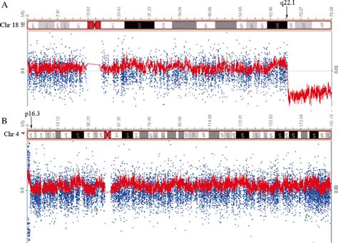 SNP array-based chromosome analysis. a Identification of the deletion... | Download Scientific ...