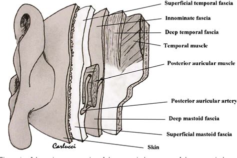 Reconstruction of the retroauricular fold by 'nonpedicled' superficial mastoid fascia: details ...