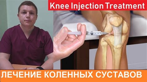 Knee Treatment Injection l Внутрисуставные инъекции в коленный сустав - YouTube