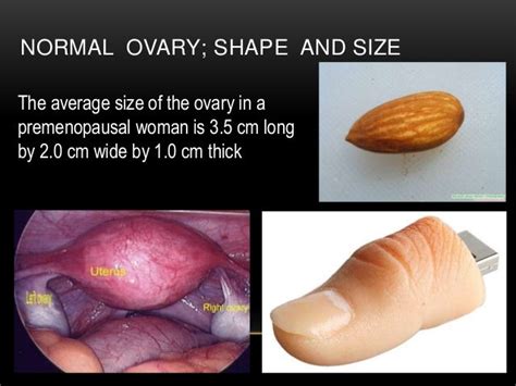 Basic gynae ultrasound