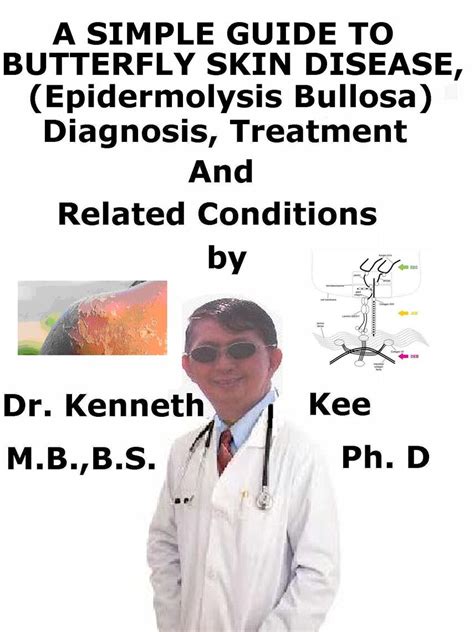 A Simple Guide to Butterfly Skin Disease (Epidermolysis Bullosa ...