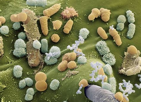 Bacteria and Fungus seen in the Scanning and Transmission Electron ...