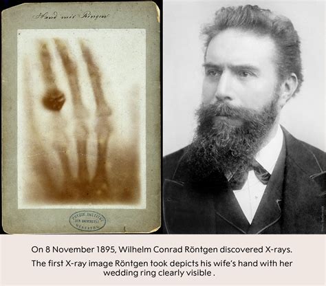 OnThisDay in 1895, Wilhelm Conrad Röntgen discovered X-rays. Röntgen ...