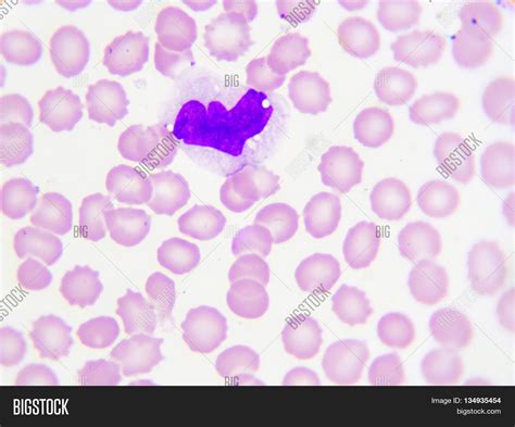 Monocyte Cell (white Image & Photo (Free Trial) | Bigstock