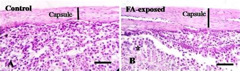 Histology of capsule of testes of adult pigeons. A. Showing normal... | Download Scientific Diagram