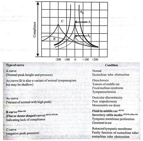 Tympanogram ... (*) Fluid "B"har jayega - B wave ... (*) "D"iscontinuity - D wave Audiologist ...