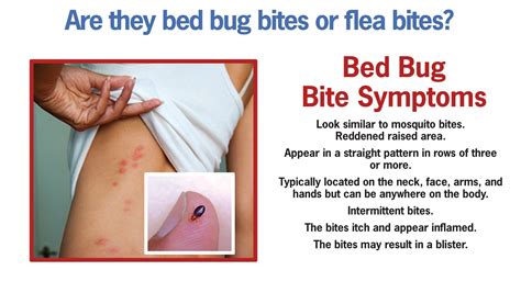 Island Pest Control | Bed Bug Bite Symptoms – Hilton Head Island, Bluffton and Beaufort