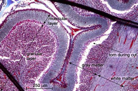 Exploration of Human Brain Tissue