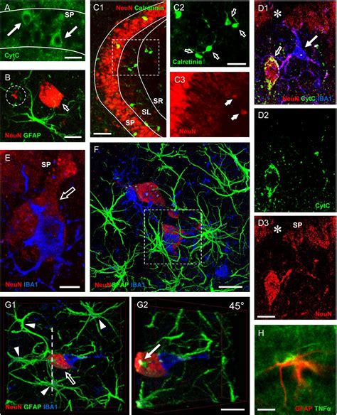 Frontiers | An Overview on the Differential Interplay Among Neurons ...