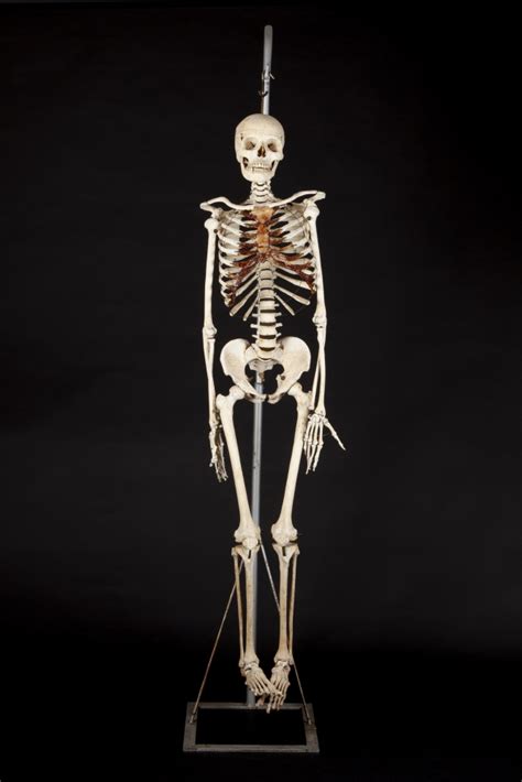 Taxidermy 1920s real Human Skeleton ex medical study