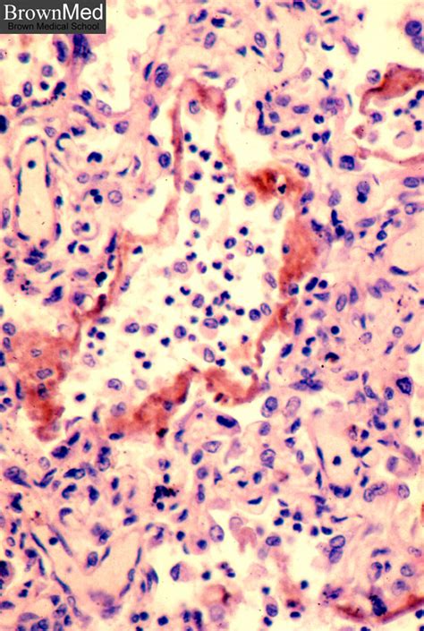 Membrane Histology