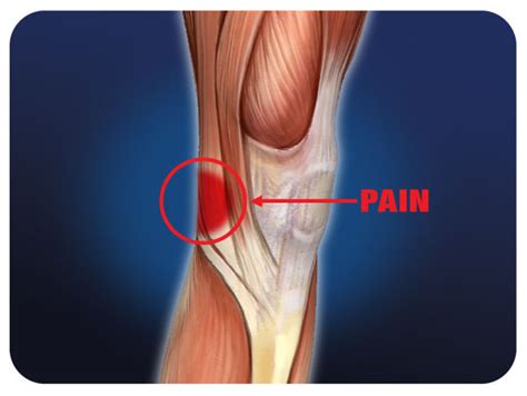 Pain Behind Knee | Med-Health.net