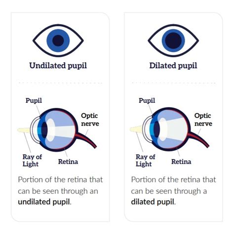 Comprehensive dilated eye exams