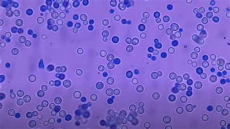 Methylene Blue Stain: Introduction, Principle, Composition, Preparation