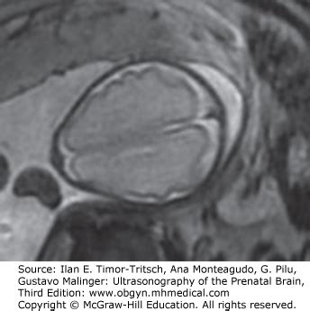 CRANIOFACIAL ANOMALIES | Radiology Key