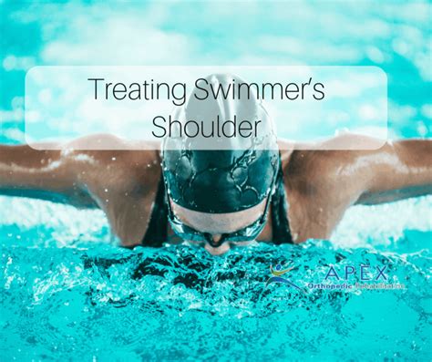 Treating Swimmer’s Shoulder | Apex Orthopedic