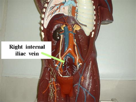 Внутренняя подвздошная вена - Internal iliac vein - Википедия