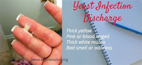 What Pest Causes An Oily Odor / This smell is usually extremely pungent and might strike you as ...