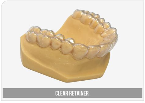 Clear Retainer – Solutions Dental Lab