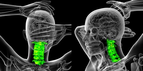 Cervical Vertebrae Anatomy C7