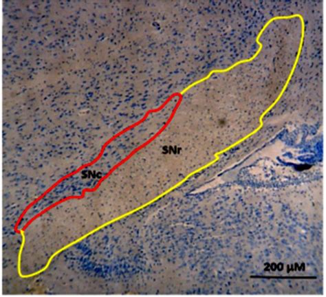 Photomicrograph of coronal section from the mice substantia nigra (SN ...