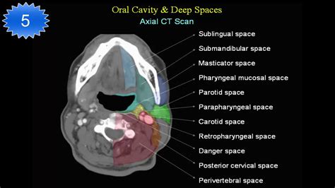 ct neck study - YouTube