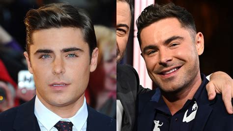 Zac Efron Face Before & After Jaw Surgery, Plastic Surgery, Filler ...