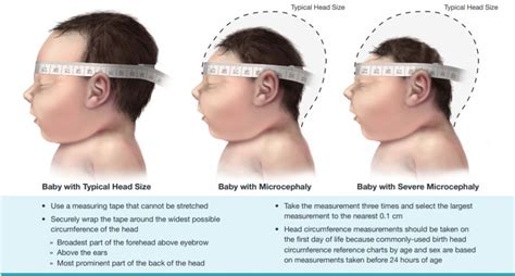 Measuring Head Circumference – Richmond Hill Children's Clinic