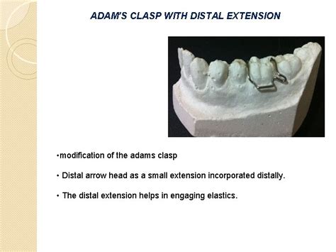 ADAMS CLASP Parts Two arrow heads Bridge Retentive