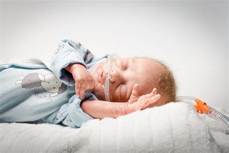 Neonatal ventilation solutions