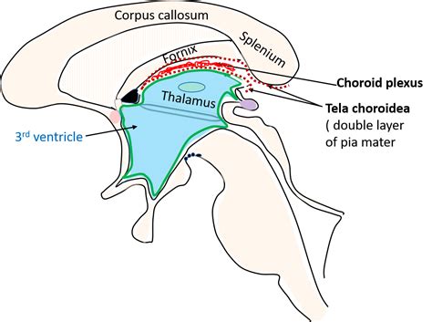 Third Ventricle - Location, boundaries, recesses and choroid plexus