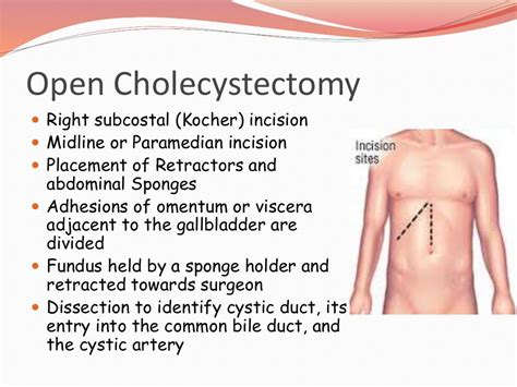 Open Vs Laparoscopic cholecystectomy