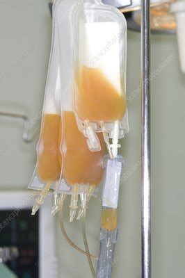 Blood platelets for transfusion - Stock Image - C005/6482 - Science Photo Library