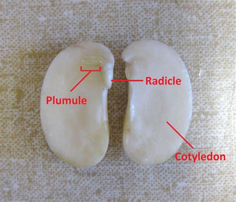 UBC Biology 210 Blog: Lab 4 - Stems: Structure and Function