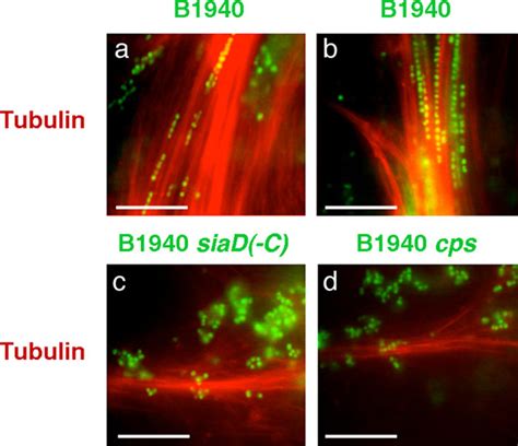 Interaction between N. meningitidis strains and microtubule bundles ...