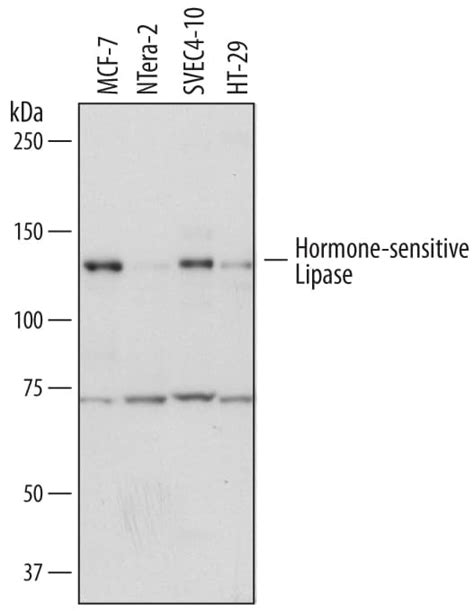 Hormone-sensitive Lipase/HSL Research Products: Novus Biologicals