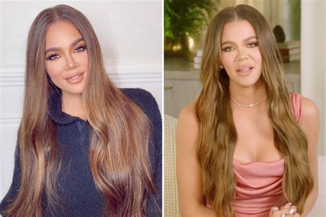 Khloe Kardashian slammed for 'botched' lips and 'unrecognizable' face ...