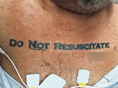 His Tattoo Said ‘Do Not Resuscitate.’ Doctors Wanted Another Opinion. - The New York Times