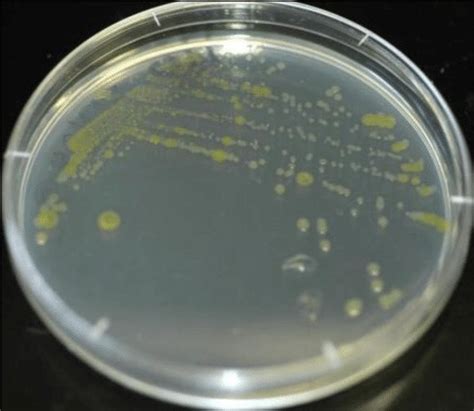 Streak Plate Method - Explained - Laboratoryinfo.com