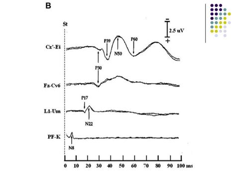 Somatosensory evoked potentials