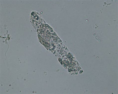 granular cast Archives | eClinpath