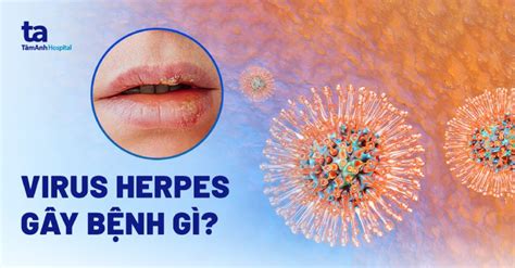 Virus Herpes là gì? Gây ra những bệnh nào? Có nguy hiểm không?