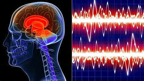 Novel Brain Cancer Treatment Taps Into Sound Waves | Everyday Health