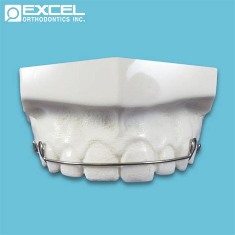 Bow Options - Excel Orthodontics