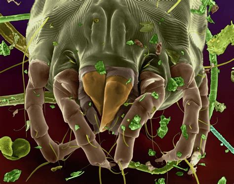 Dust Mite Electron Microscope